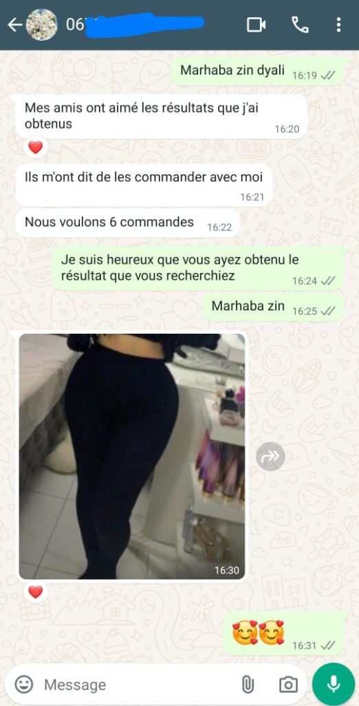 WhatsApp-Image-2024-08-01-at-16.32.53-1-522x1024-1.jpeg